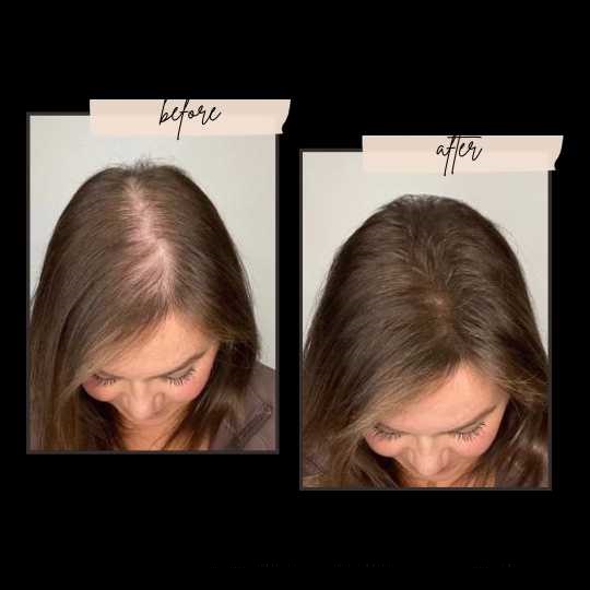 Toppik Before and after women